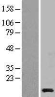 NDUFB2 Human Over-expression Lysate