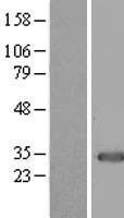 MOX1 (MEOX1) Human Over-expression Lysate