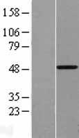 Vitamin D Receptor (VDR) Human Over-expression Lysate