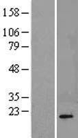 Calcineurin B (PPP3R1) Human Over-expression Lysate