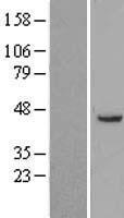 Squalene Epoxidase (SQLE) Human Over-expression Lysate