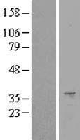 SURF1 Human Over-expression Lysate