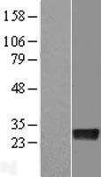 Density Regulated Protein (DENR) Human Over-expression Lysate