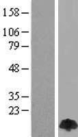 DYNLL1 Human Over-expression Lysate