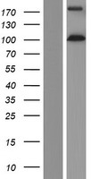 EIF3B Human Over-expression Lysate