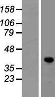 LDB1 Human Over-expression Lysate