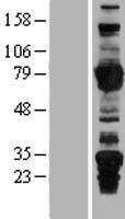 ARHGEF7 Human Over-expression Lysate