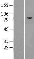 eIF2B epsilon (EIF2B5) Human Over-expression Lysate