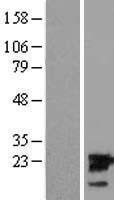 UBE2M Human Over-expression Lysate