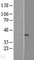 NDUFB1 Human Over-expression Lysate