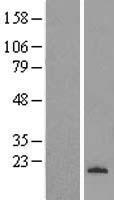 Tryptophan rich protein (WRB) Human Over-expression Lysate