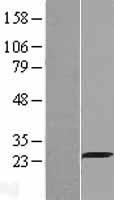 Grancalcin (GCA) Human Over-expression Lysate