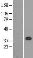 FAIM2 Human Over-expression Lysate