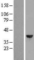 DCPS Human Over-expression Lysate