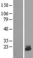 UBE2D4 Human Over-expression Lysate