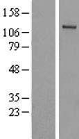 UBA6 Human Over-expression Lysate