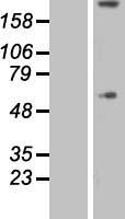 COL8A1 Human Over-expression Lysate