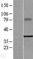 CRELD2 Human Over-expression Lysate