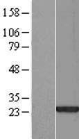 SAP30L Human Over-expression Lysate