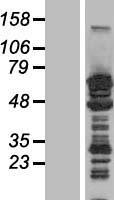 MAP2 Human Over-expression Lysate