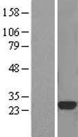 CTHRC1 Human Over-expression Lysate