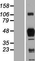 Macrophage Scavenger Receptor I (MSR1) Human Over-expression Lysate
