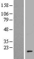 AHSA2P Human Over-expression Lysate