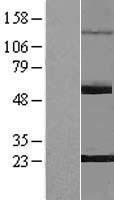 PNLDC1 Human Over-expression Lysate