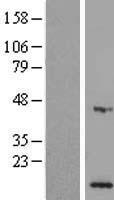 MPV17L Human Over-expression Lysate
