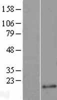 AJUBA Human Over-expression Lysate