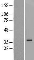 MGC12965 Human Over-expression Lysate