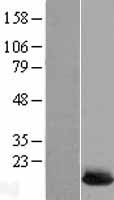 UBE2L6 Human Over-expression Lysate