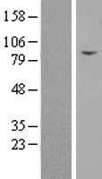 Transglutaminase 5 (TGM5) Human Over-expression Lysate