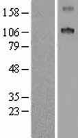 SCUBE1 Human Over-expression Lysate