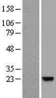 ZG16B Human Over-expression Lysate