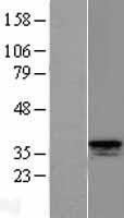 CISH Human Over-expression Lysate