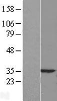 Caspase 3 (CASP3) Human Over-expression Lysate