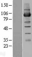 NSUN2 Human Over-expression Lysate