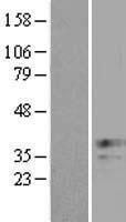 XAF1 Human Over-expression Lysate