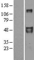 EFEMP2 Human Over-expression Lysate