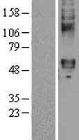 Frizzled 4 (FZD4) Human Over-expression Lysate
