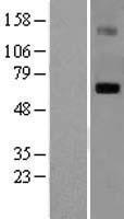 LGI1 Human Over-expression Lysate