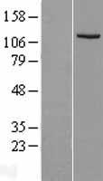 IDE Human Over-expression Lysate