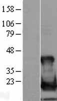 UBE2L6 Human Over-expression Lysate