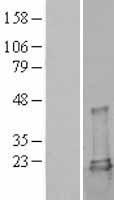 UBE2L3 Human Over-expression Lysate