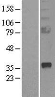 SFRP2 Human Over-expression Lysate