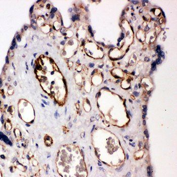 CD31/PECAM1 Rabbit Polyclonal Antibody