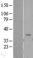LIF Human Over-expression Lysate
