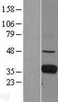FCN1 Human Over-expression Lysate