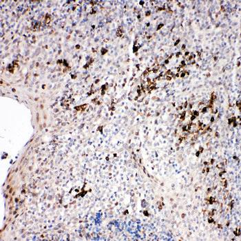 TRAF2 Rabbit Polyclonal Antibody